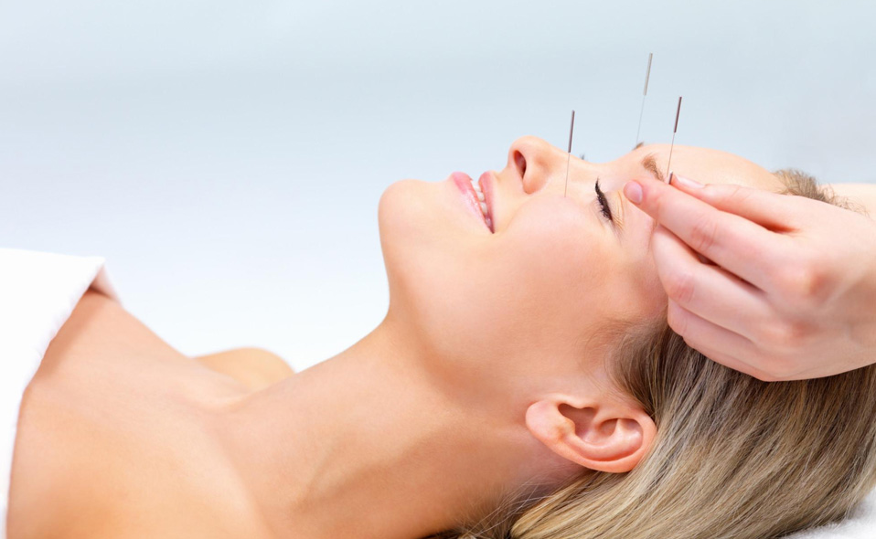 How is Acupuncture Treatment Done?
