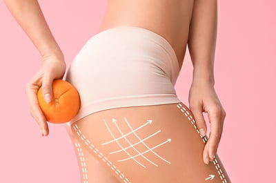 Enzymatic Cellulite Treatment